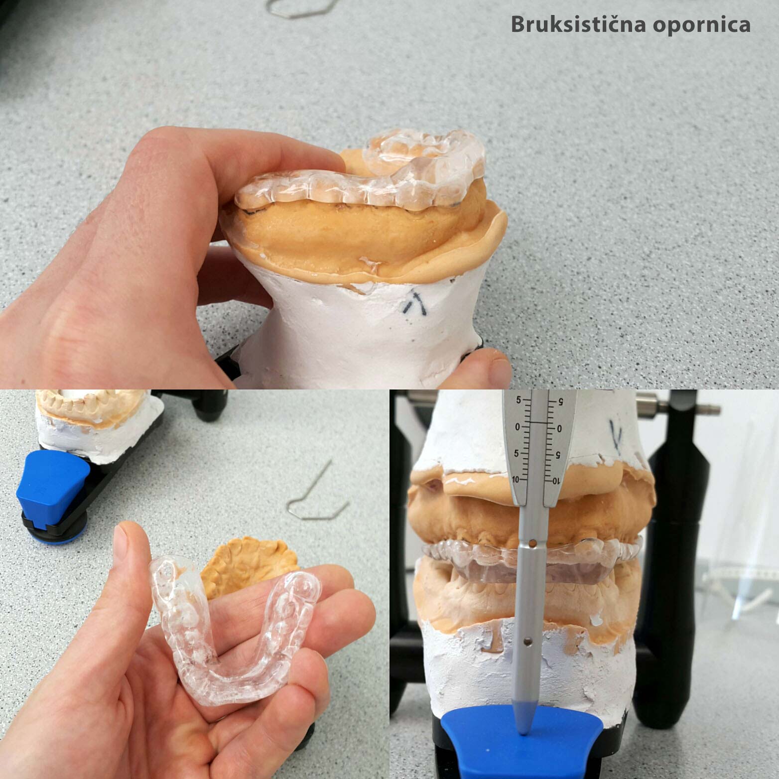 Bruksisticna_opornica